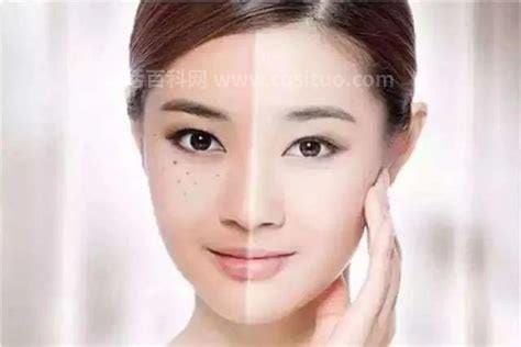 脸部皮肤粗糙怎么改善