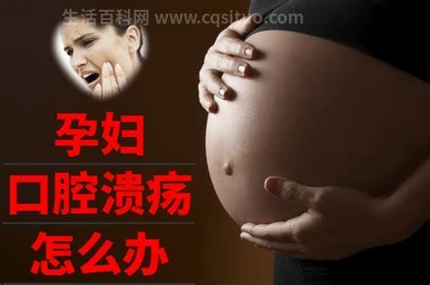 孕妇口腔溃疡怎么办