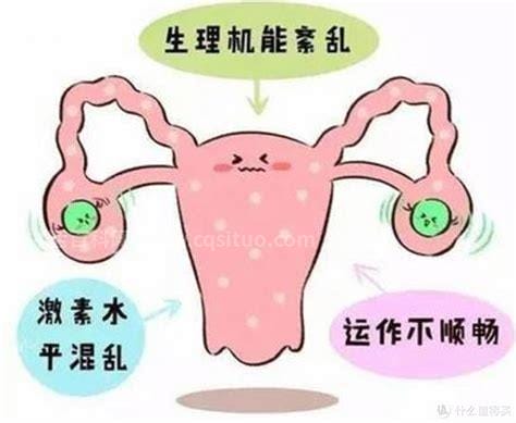 卵巢肿瘤的症状有哪些