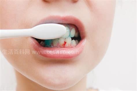 牙龈出血是什么病的征兆