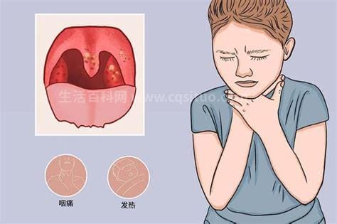 喉咙痛怎么办咽口水都痛
