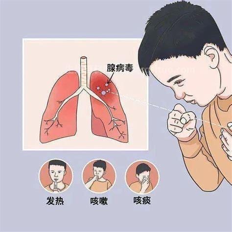 新冠肺炎早期的5个信号，出现发热/干咳/乏力等