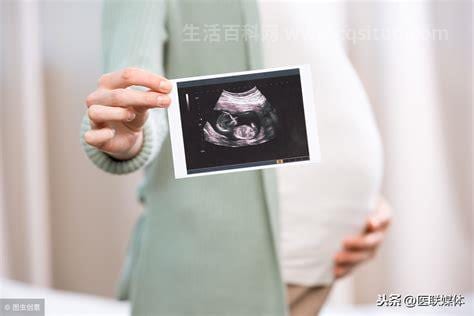 孕妇照四维需要多少钱，300-500元(孕22-26周清除胎儿停止发育)