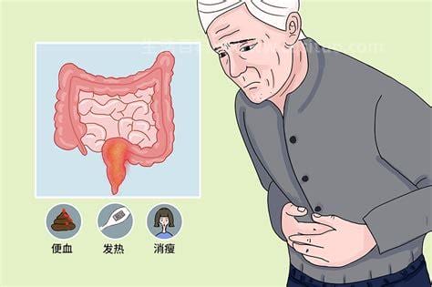 直肠炎会出现什么症状