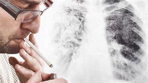 肺结核可以吸烟吗