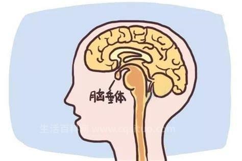 什么样的人容易垂体瘤