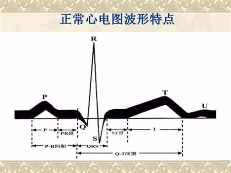 Ecg正常值是多少