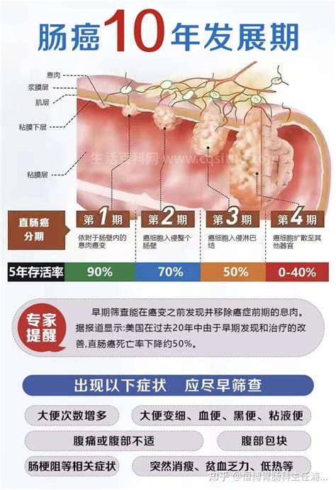 大肠息肉症状是什么