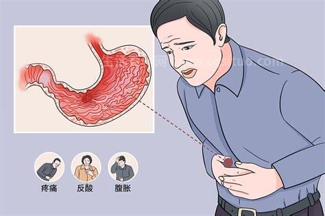 胃炎有什么症状如何治疗