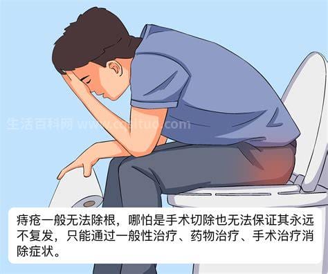 男人痔疮怎么治