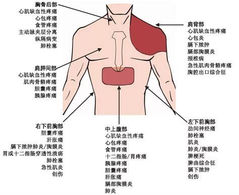 右胸痛怎么办