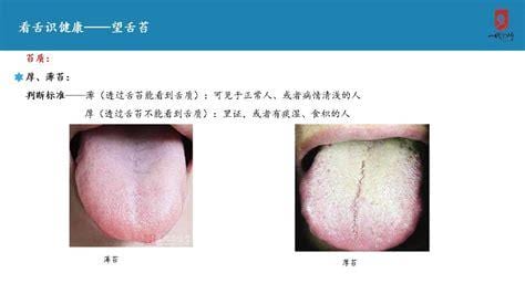 舌头痛是什么原因造成的