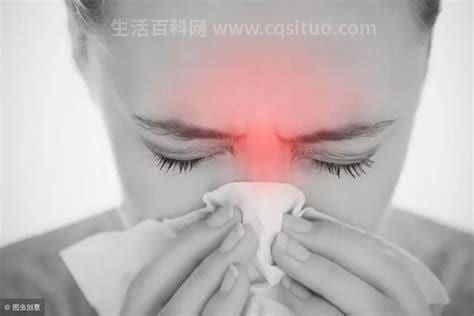 过敏性鼻炎有哪些症状