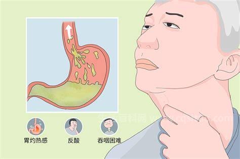食管炎的症状有哪些
