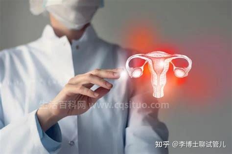 多囊卵巢能治好吗