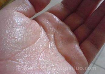 手脚容易出汗是什么原因