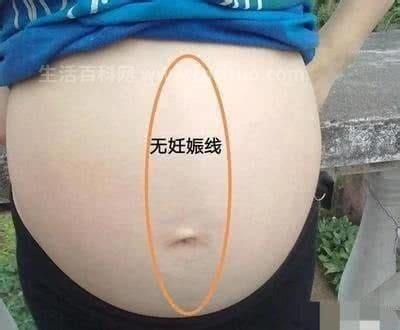 没怀孕肚子有一条黑线是怎么回事