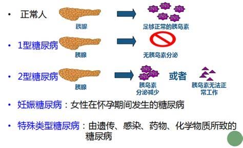 糖尿病的分类有几种