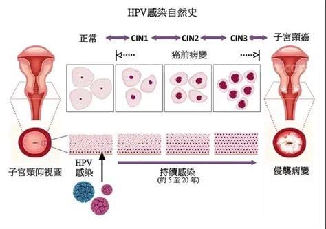 宫颈疾病都有哪些