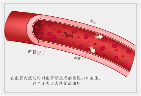 高血脂是什么