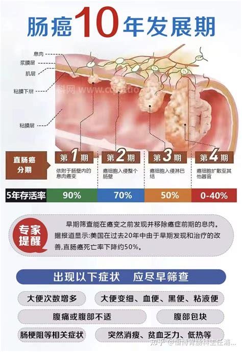 肠道息肉是什么