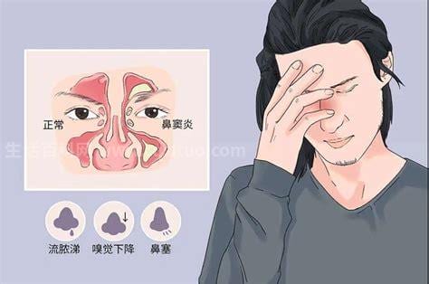 副鼻窦炎症状是什么