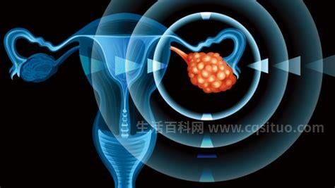 卵巢癌的症状都有什么