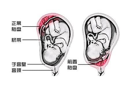 子宫后壁是什么意思