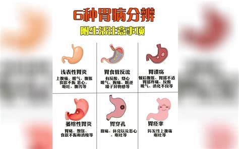 什么是非萎缩性胃炎