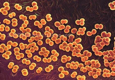 什么是葡萄球菌感染