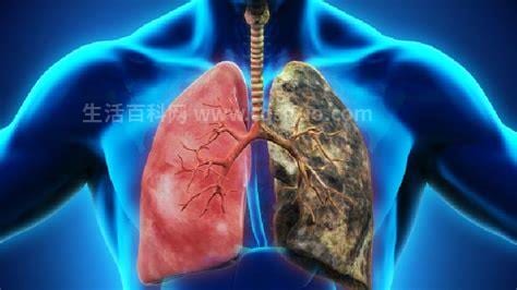 肺气肿的体征有哪些