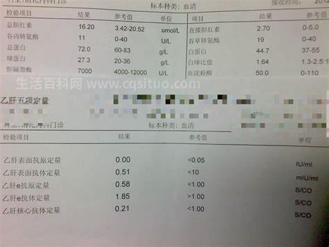 尿淀粉酶正常值是多少