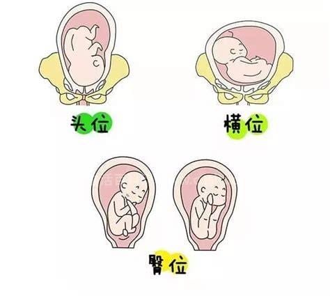 什么是胎位图