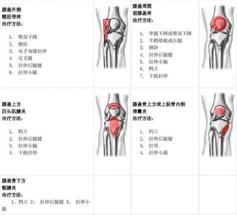 膝盖各个部位疼痛图解 膝盖的不同