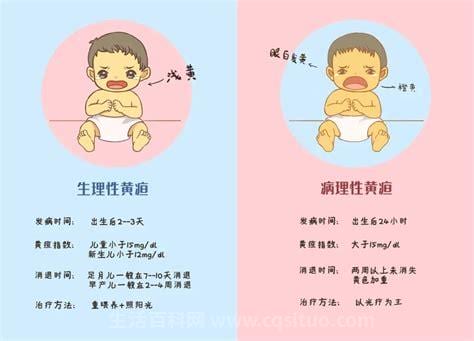 新生儿黄疸的症状一般有哪些