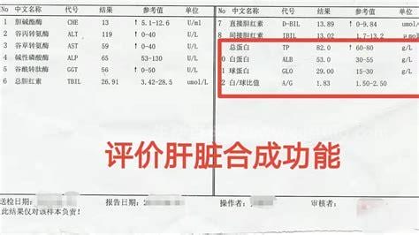 肝硬化指标怎么看化验单