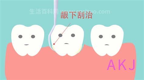 阿莫西林能治疗牙周炎吗