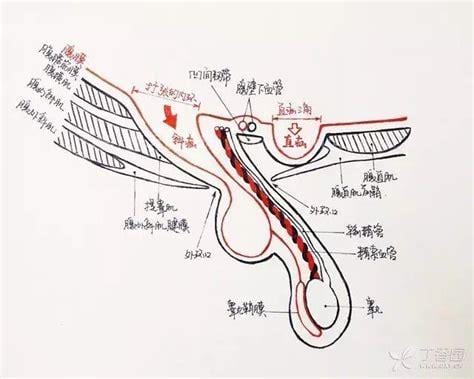 疝气的症状