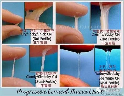 白带多是什么原因造成