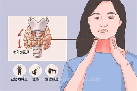 甲状腺功能减退是什么原因