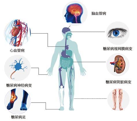 血糖高的危害