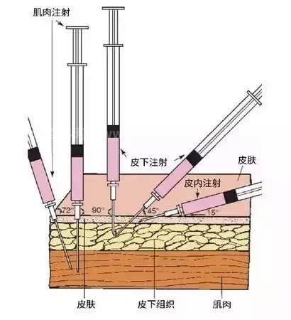 皮下肌肉注射流程及标准