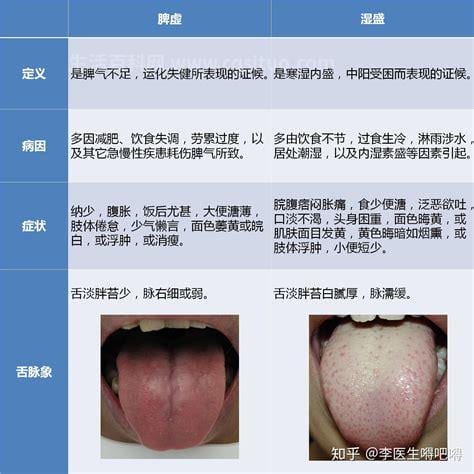 脾虚的人如何调理