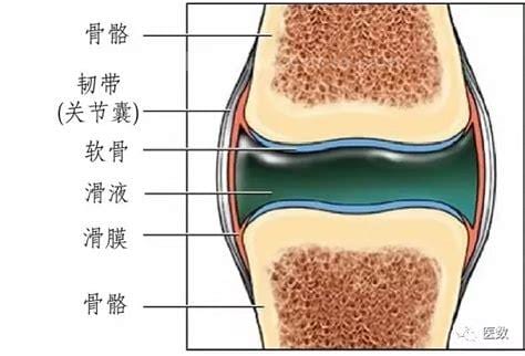 滑膜炎和滑囊炎有什么区别