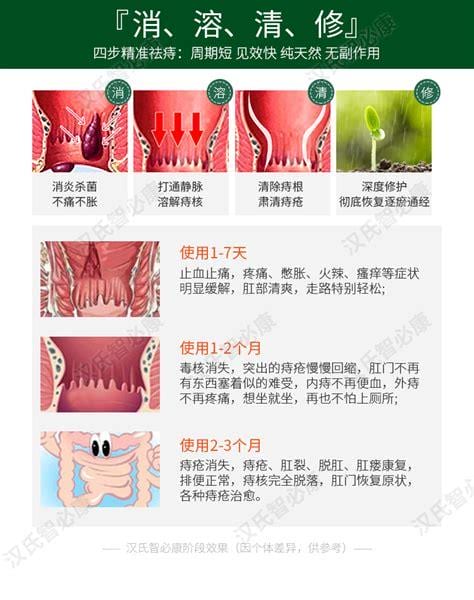 外痔肉球消除办法