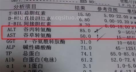 转氨酶偏高是什么原因