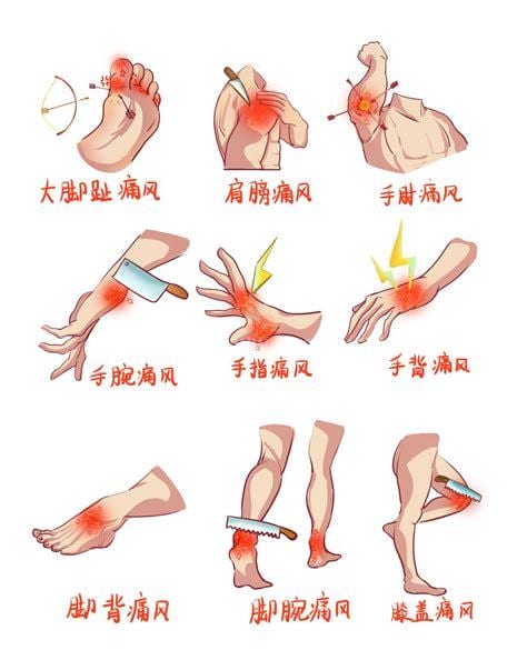 痛风常见部位是哪里