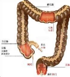 直肠炎的症状