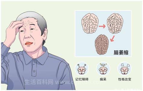 小脑萎缩症状