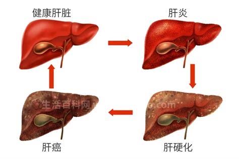 肝脏不好的症状